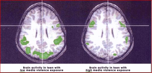 Teen brain activity during low and high 'violence' video game exposure